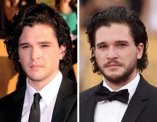 Beard Or No Beard You Decide Which Celebrities Look Better