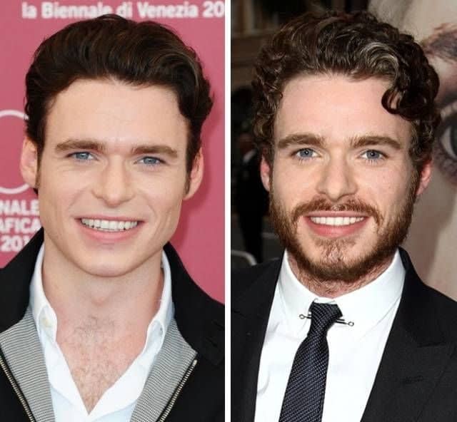 Beard Or No Beard You Decide Which Celebrities Look Better